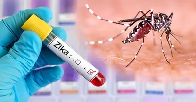 zika virus advisory   जीका वायरस को लेकर स्वास्थ्य मंत्रालय का अलर्ट  सभी राज्यों को जारी की एडवाइजरी